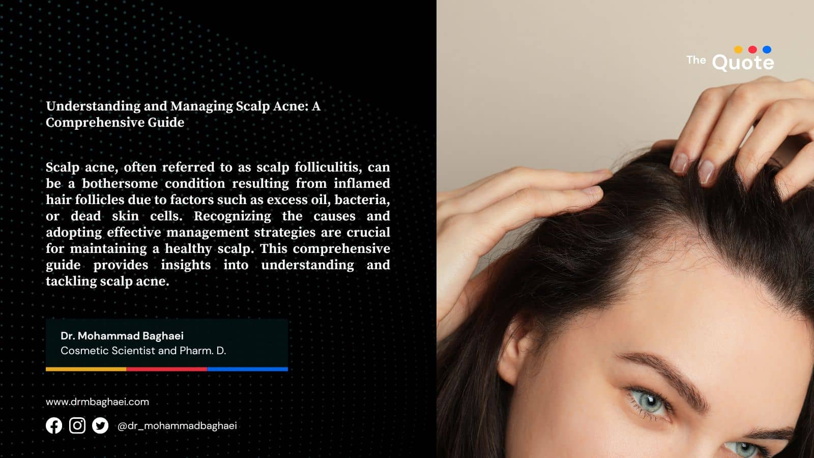 Understanding and Managing Scalp Acne: A Comprehensive Guide